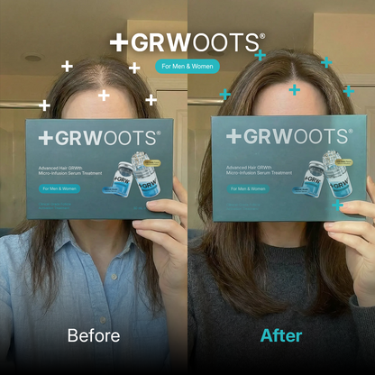 GRWOOTS® Micro-Infusion Hair Growth Treatment