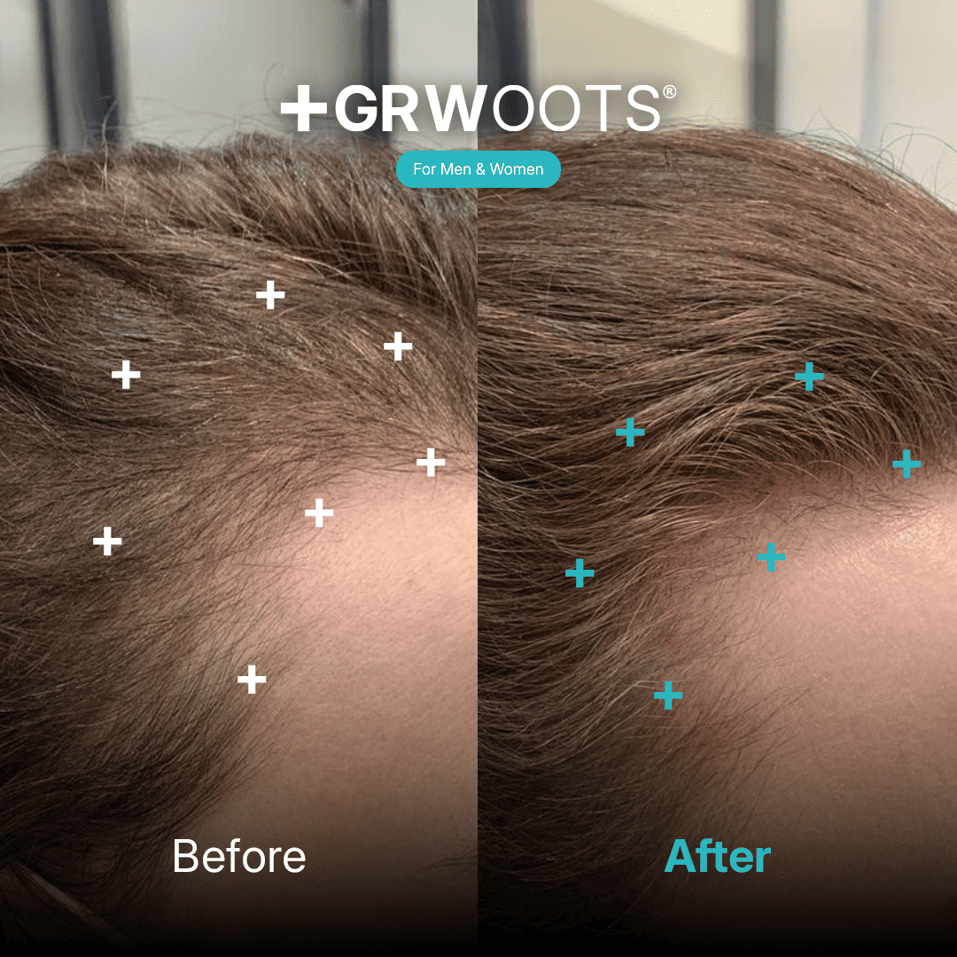 women hair growth solution